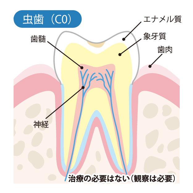 春日市（福岡） 歯医者、とくだ歯科医院の一般歯科