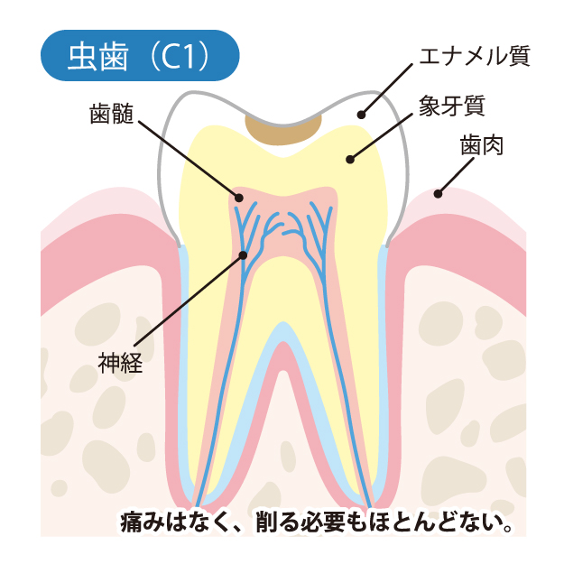 春日市（福岡） 歯医者、とくだ歯科医院の一般歯科