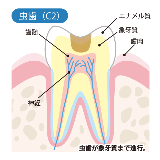 春日市（福岡） 歯医者、とくだ歯科医院の一般歯科