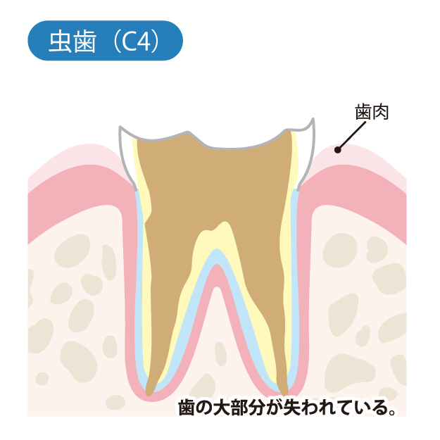 春日市（福岡） 歯医者、とくだ歯科医院の一般歯科